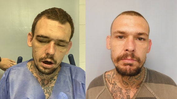 Deputies: Torch-wielding man soaked himself, hostage with gasoline during SWAT standoff