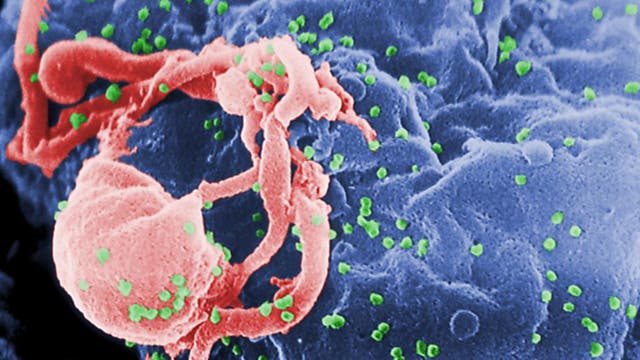 Emory University participating in first-of-its-kind HIV vaccine trial