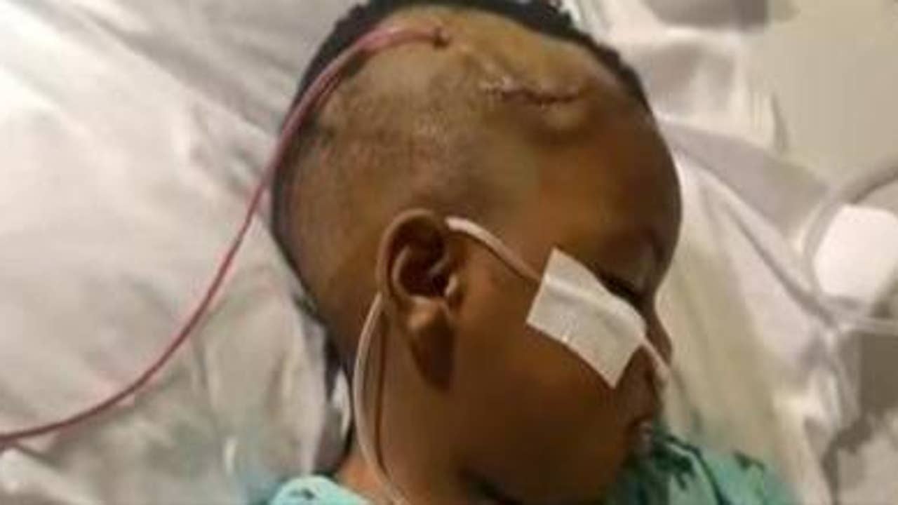 Bullet removed from toddler’s head, 2nd child was inside car shot up at Atlanta traffic light, family says