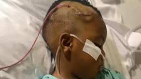 Bullet removed from toddler's head, 2nd child was inside car shot up at Atlanta traffic light, family says