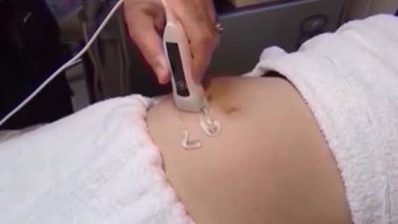 Expert weighs in on Georgia's ability to claim unborn children as dependents on taxes