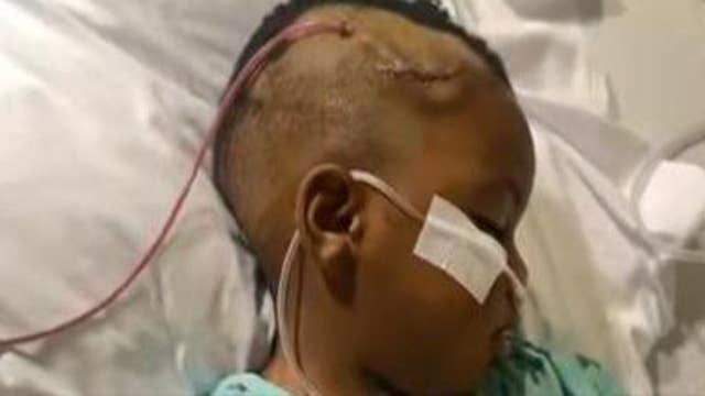 Bullet removed from toddler's head, 2nd child was inside car shot up at Atlanta traffic light, family says