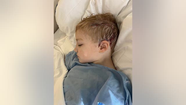 Woodstock police officer's 5-year-old son recovering after cancer surgery