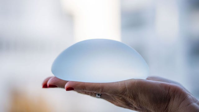 FDA warns of rare cases of cancers possibly linked to breast implants