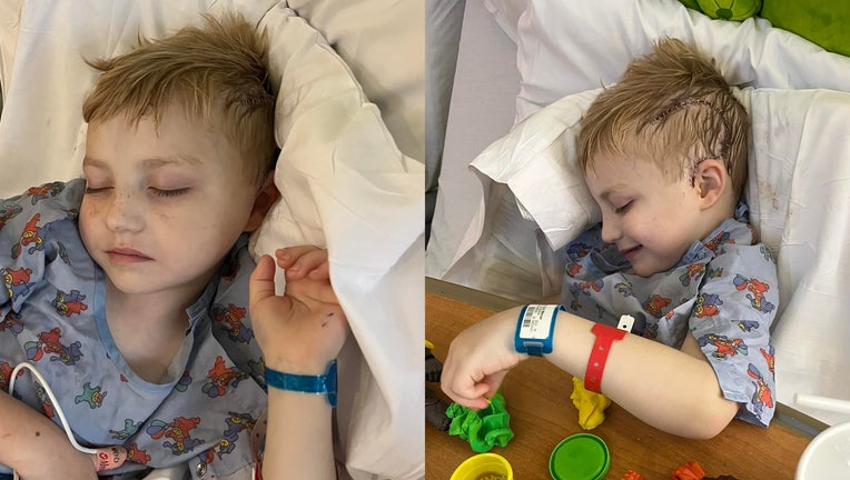 Five-year-old Ezra King's surgery began Wednesday morning at Children’s Scottish Rite Hospital