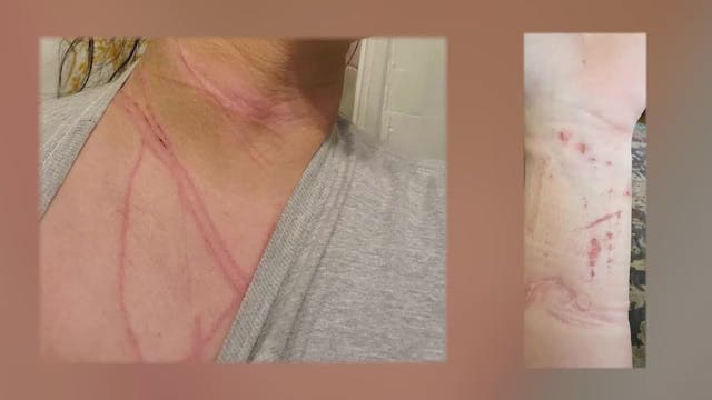 Covington residents on edge after attack on popular walking trail