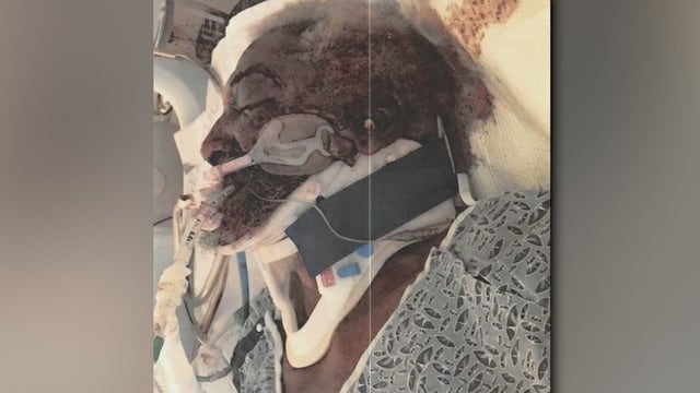 Homeless man to receive multi-million-dollar payout after incident with police