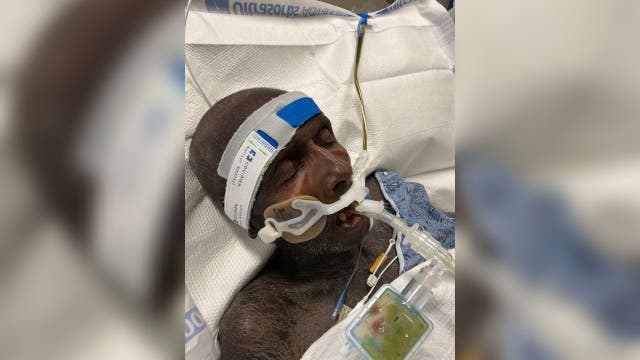 Do you recognize him? Unidentified man checked into Grady Memorial Hospital