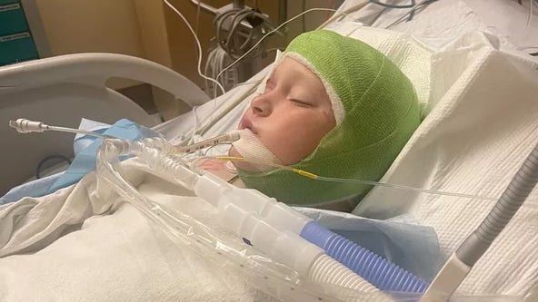 Facebook community rushes to aid Georgia boy who was mauled by three pit bulls