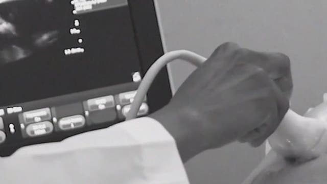 New project highlights stories of Black mothers who survived near-fatal pregnancy, childbirth complications