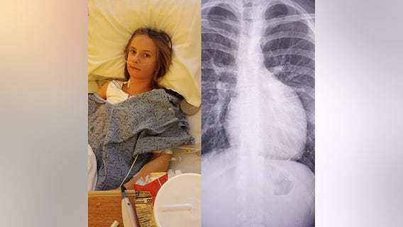 Georgia girl, 12, has already survived two major health challenges