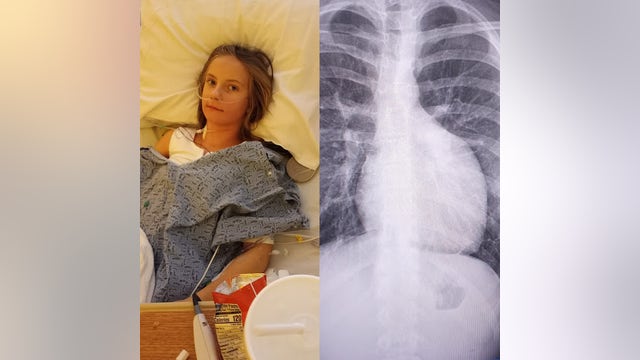 Georgia girl, 12, has already survived two major health challenges