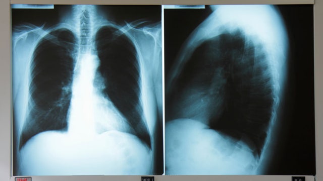 Georgia countertop manufacturer fined $33K for silica safety violations