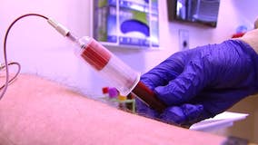 Blood shortage: Critical need for donations in north Georgia; hospitals postpone elective surgeries