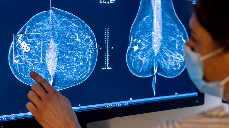 Mammography