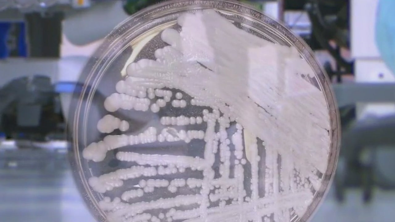 CDC warns emerging fungus can cause severe, deadly infections in