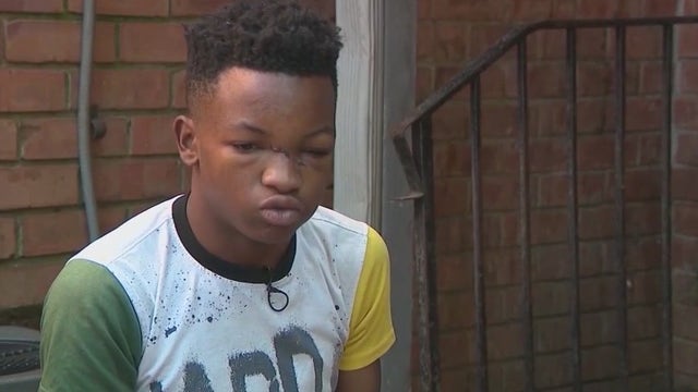 Mother of Atlanta teen shot, killed inside condemned apartment complex files lawsuit