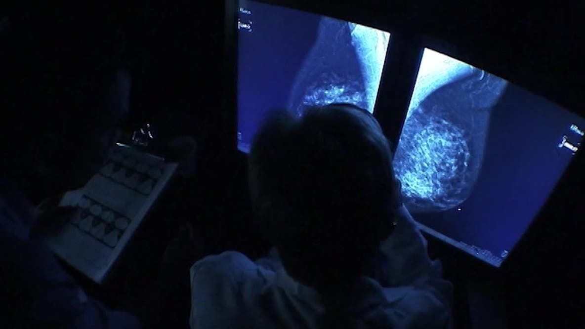 Free breast exams being offered in Cherokee County