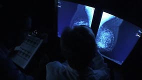 Free breast exams being offered in Cherokee County