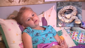 8-year-old bitten by venomous snake at Georgia lake