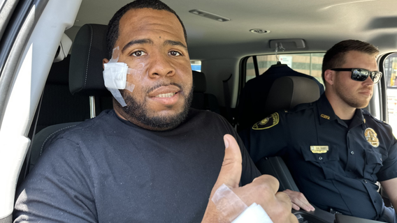 Recovering Covington officer shot in face says 'Thank you' for the prayers