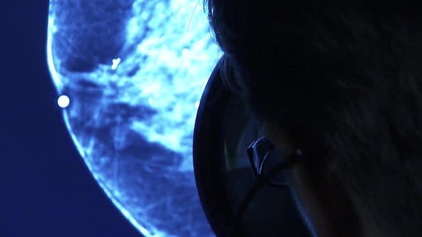 Surgeon discusses breast cancer risk assessment tools Olivia Munn credits with saving her life