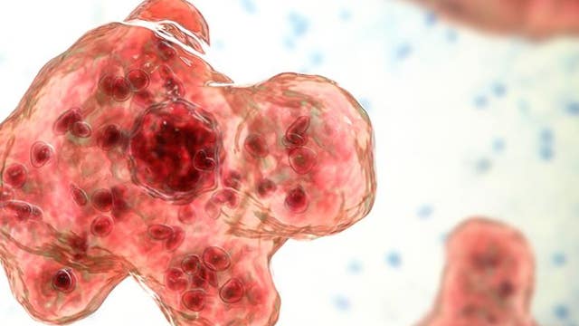 Georgia resident dies from brain-eating amoeba, according to public health dept.