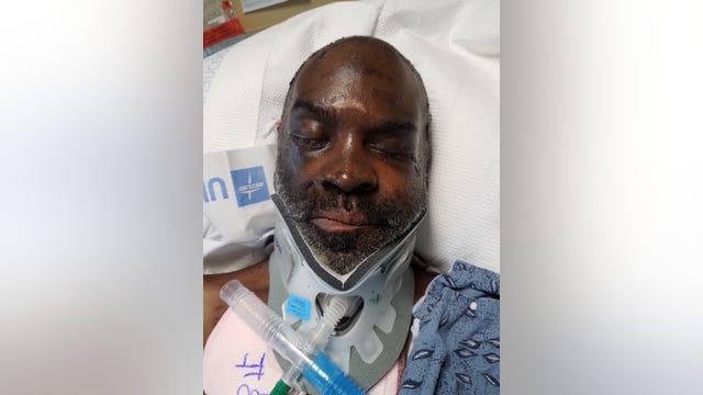 Grady needs help identifying patient hit by car on I-20