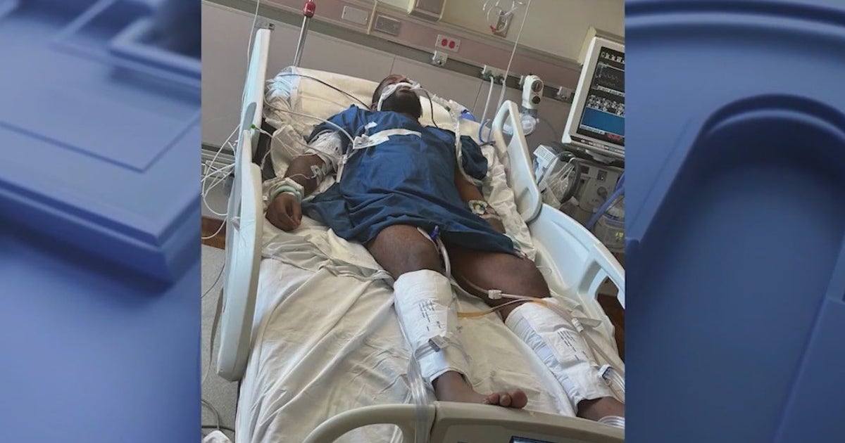 Long recovery ahead for metro Atlanta man hit by stray bullet on Labor ...
