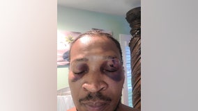 Hall County sheriff responds to man filing lawsuit over alleged assault, releases unedited video