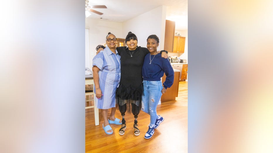 Amputee Kiyahki BIvens stands between her mother and 24-year-old daughter, wearing her prosthetic lower legs.