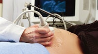 Nearly half of Georgia counties are maternity care deserts