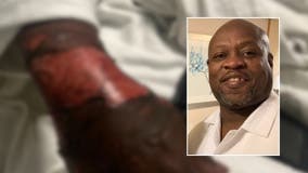 Family of Atlanta security guard burned during 'extreme protest' calls him a 'hero'