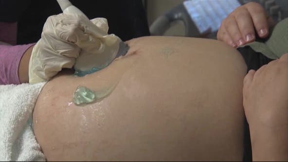 Survey: Georgians alarmed over state's high maternal mortality rate