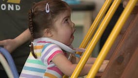 Wisconsin girl's open-heart surgery; 3-year-old has rare disorder