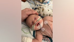 Buford newborn first in Georgia to be placed on kidney dialysis machine designed for babies