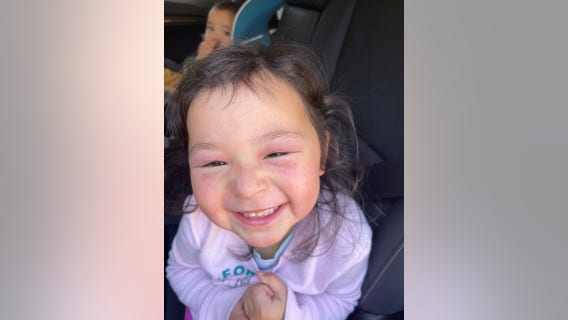 Georgia 4-year-old's eyelid rash leads to medical mystery