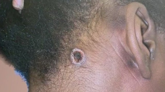 Atlanta woman hit by stray bullet while inside watching tv with brother