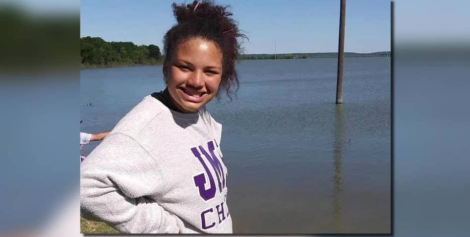 North Texas teen severely burned after boy throws pan of gas on fire, mother says