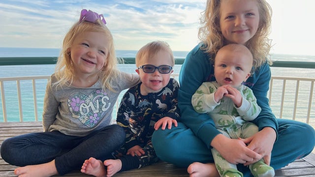 Newborn heart surgery helps toddler born with Down syndrome thrive