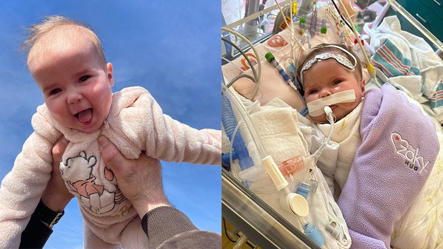 Infant undergoes successful open heart surgery at Children's Healthcare of Atlanta