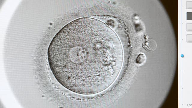 Alabama Supreme Court IVF Ruling: What frozen embryo ruling means for Georgia?