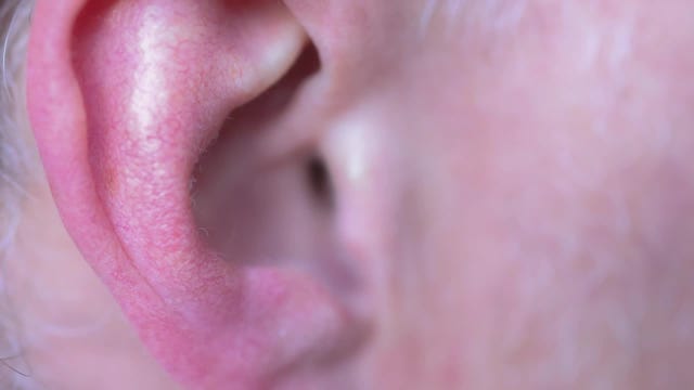 Living with Tinnitus: Marietta man says new device tames 25 years of ringing in ears