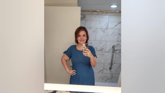 After losing 150+ pounds, Cherokee County woman undergoes excess skin removal surgery