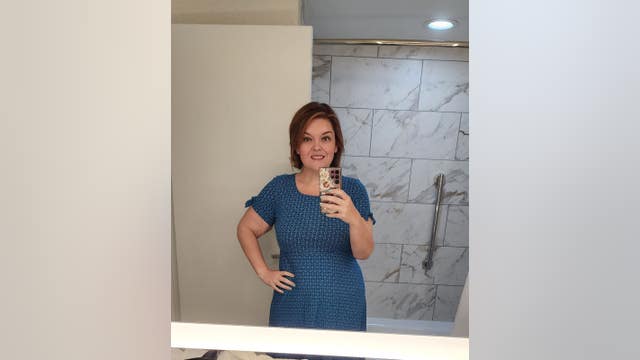 After losing 150+ pounds, Cherokee County woman undergoes excess skin removal surgery