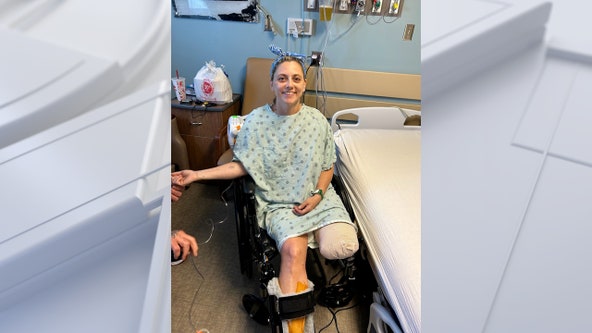 Alabama woman loses leg in boating accident, remains positive: 'I've got to make the best of it'