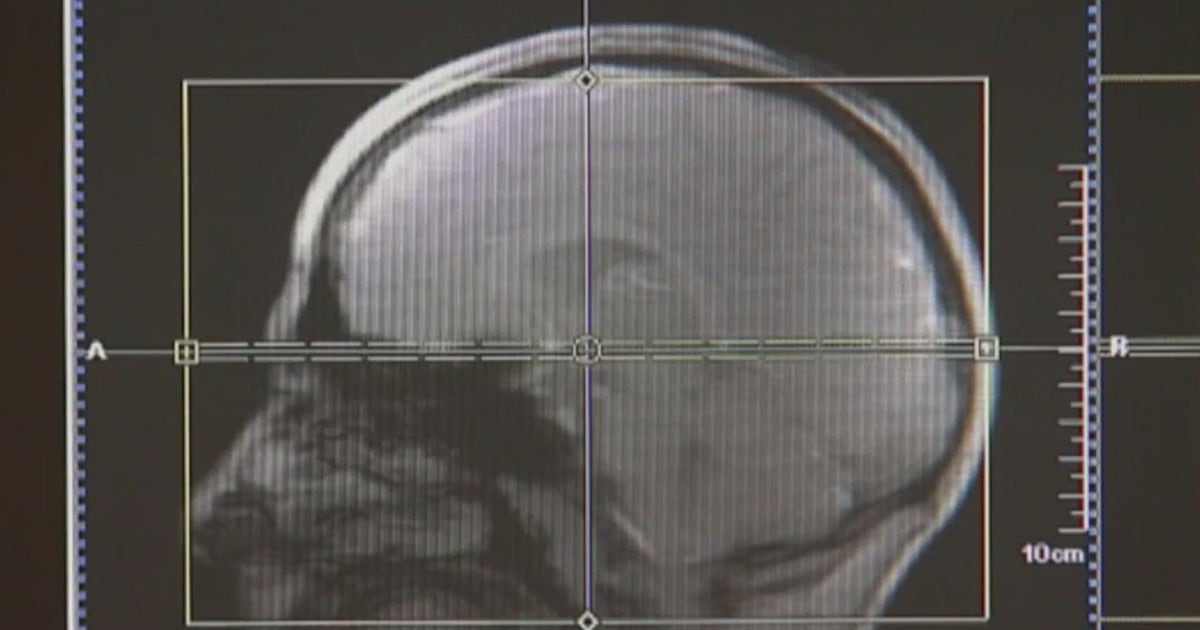 Emory Integrated Memory Care offering new payment model for patients ...