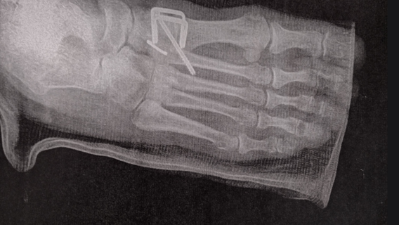 Powder Springs woman suing Cobb County police for $5M