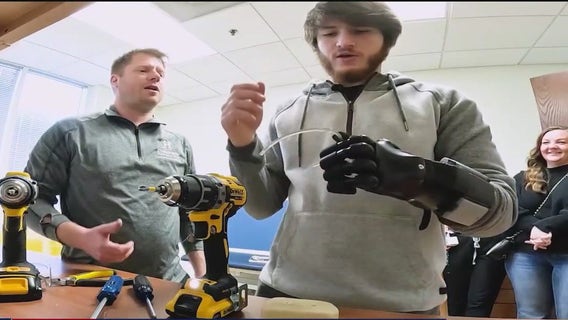 Teen wrestler without hand defying odds using high-tech prosthetic