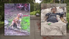 Union City woman attacked by dogs to be placed on comfort care